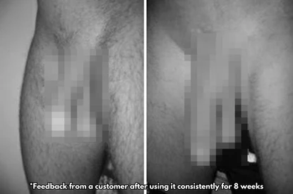 Before-and-after comparison illustrating improved firmness and endurance